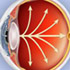 detalle-ojo-glaucoma
